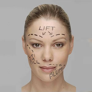 Plastic Sugery