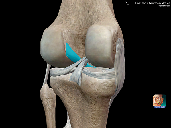anterior-cruciate-ligament-torn-ACL-knee-joint