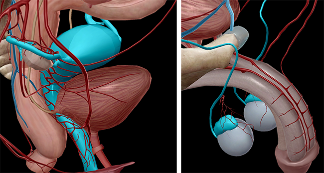 Reproductive anatomy epididymis gartner's duct Reproductive anatomy epididymis gartner's duct