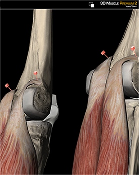 Learn Muscle Anatomy: Gastrocnemius