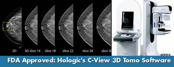 Breast tomosynthesis dose