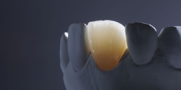 Oxiapatita – ¿Qué es?