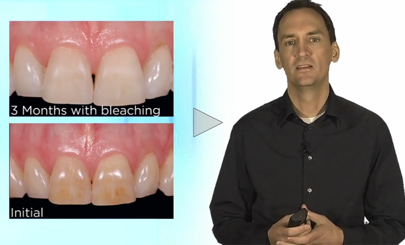 RESTORATIVE DESIGN & PRACTICAL OCCLUSIO… Patient Specific Plate for Mandible | DePuy Synthes | J&J