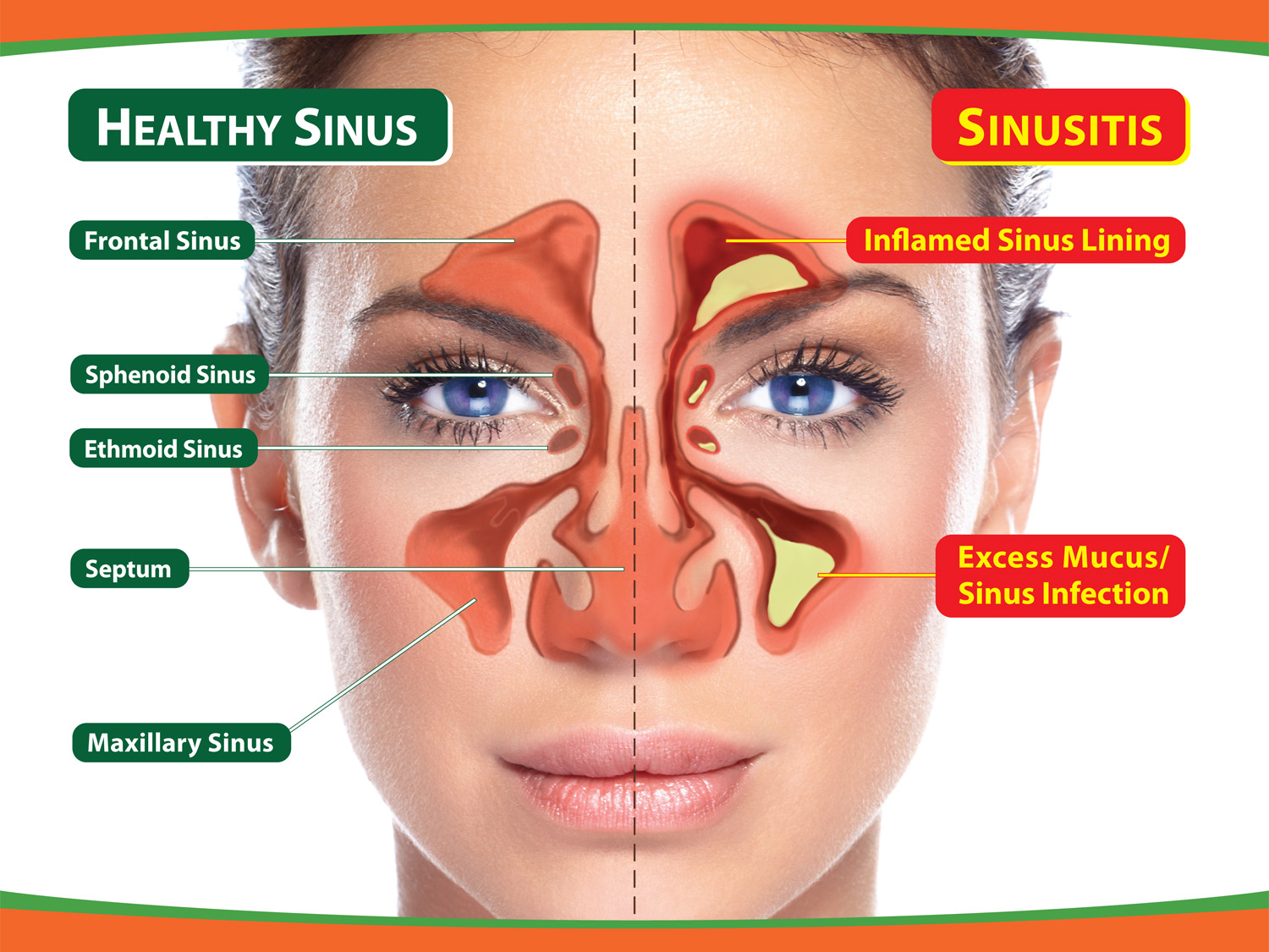 sinus surgical treatment dizzy after