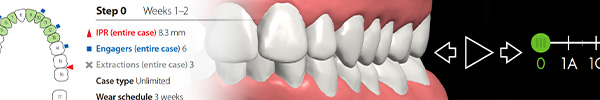 Treatment-Setup-Banner-v1