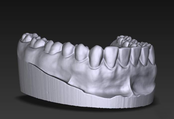 3D_dental_scan