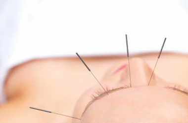 acupuncture_crop380w