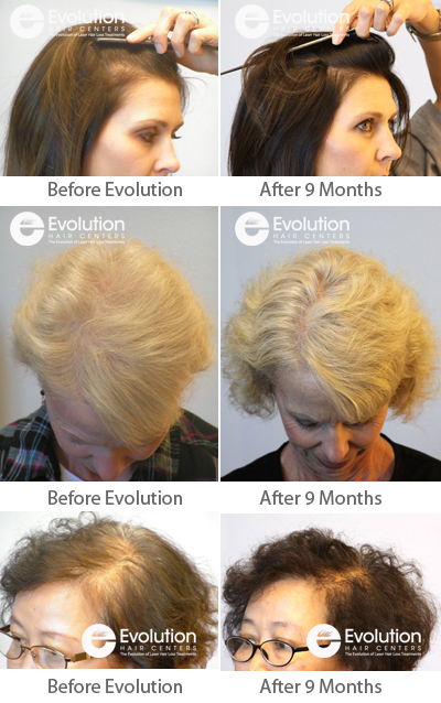 Evolution Hair Loss Institute