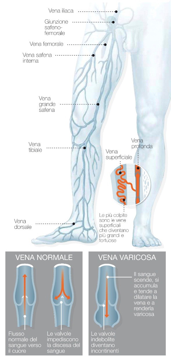 gambe