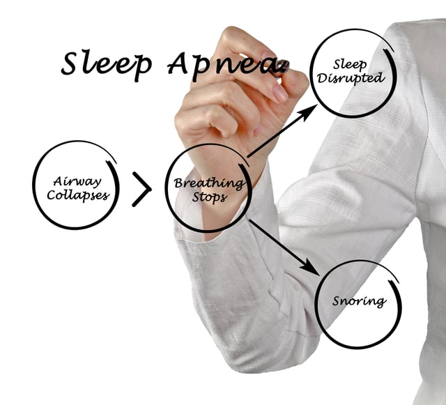 symptoms-of-sleep-apnea