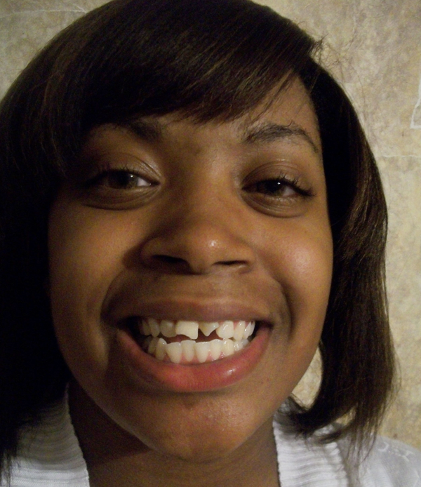 Micah Before Tomorrow's Smiles Micah Before Tomorrow's Smiles