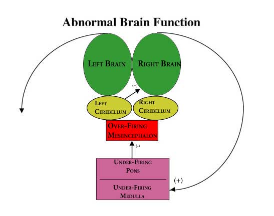 Abnormal Brain Function Schematic BBT