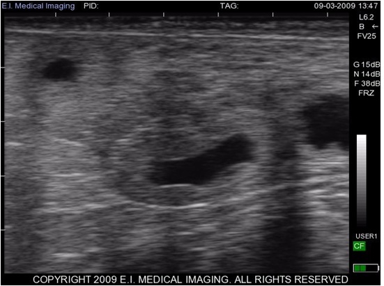 pregnancy stages day by day ibex 174 ultrasound stages of early bovine pregnancy part 1 pregnancy stages day by day ibex 174 ultrasound stages of early bovine pregnancy part 1
