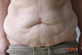 fatty tummy