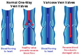 leg veins