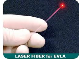 laser fiber