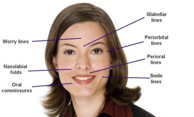 nasolabial folds