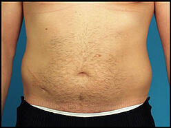 love handles