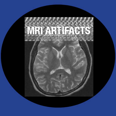 mri artifacts