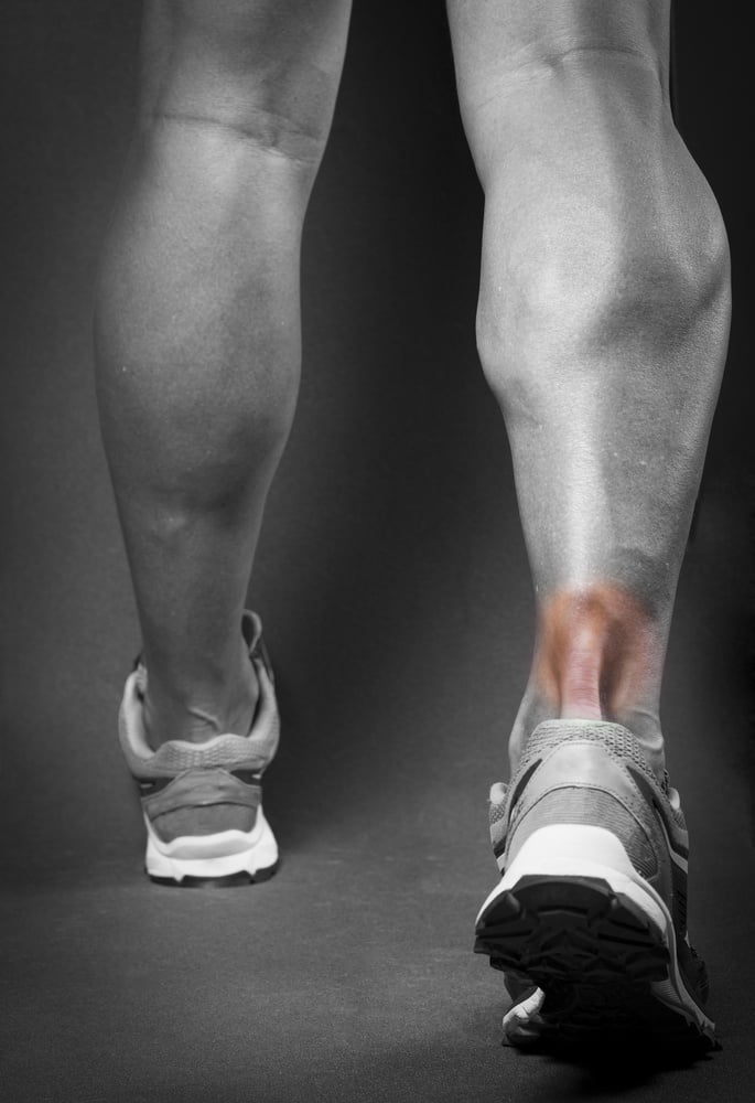 Signs of strained hot sale achilles tendon