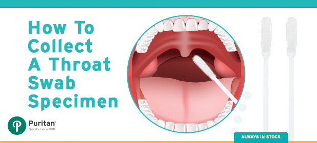 How To Do A Throat Swab 94