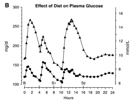Effect_of_diet_on_plasma_glucose.jpg
