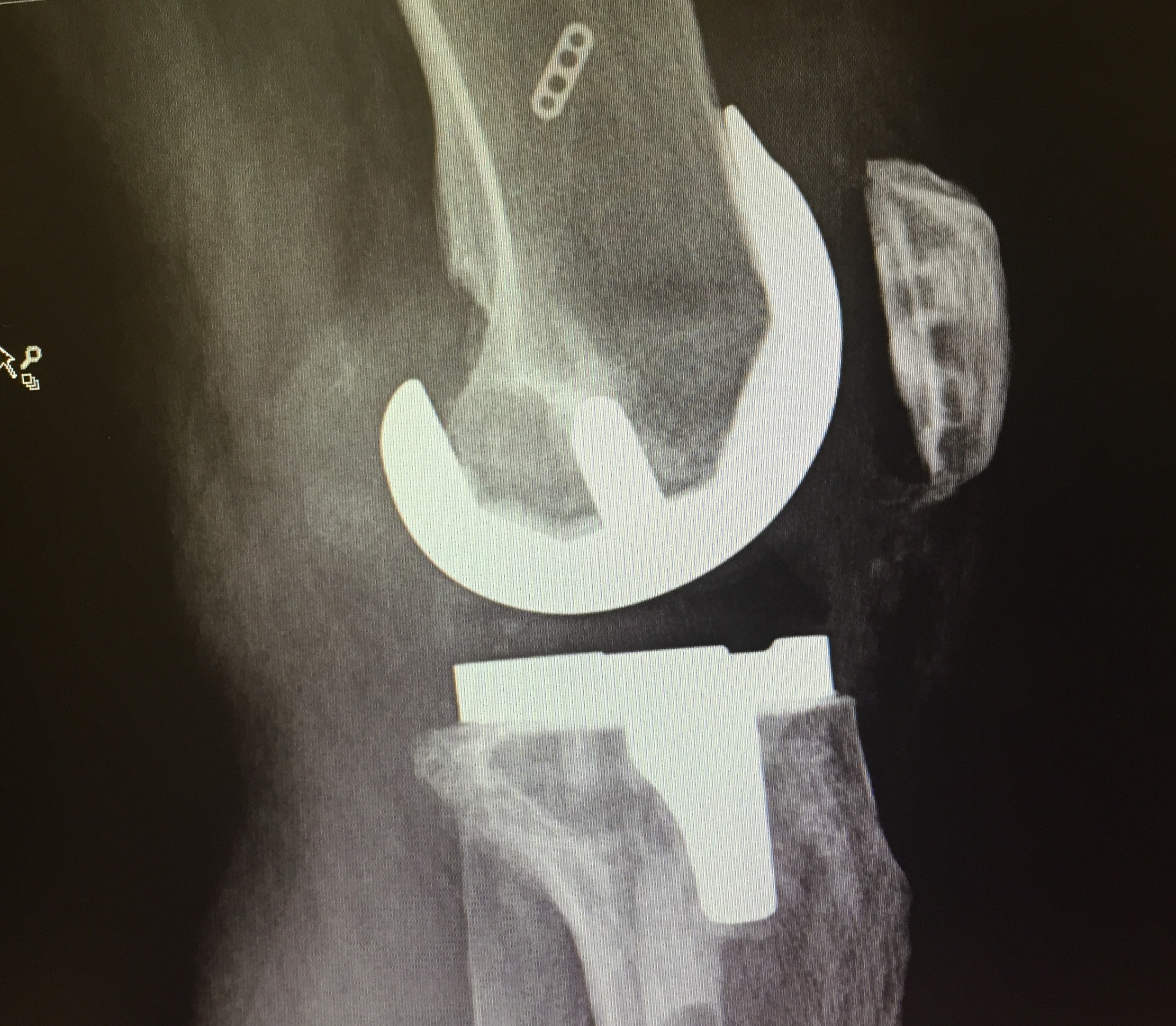 My left knee at six weeks