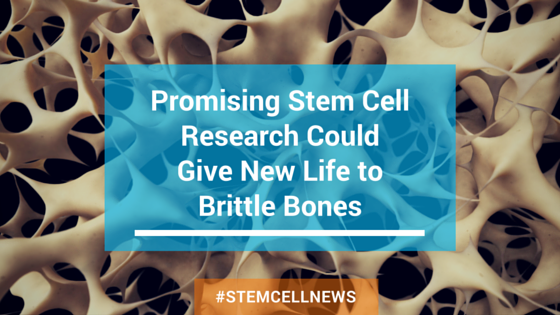 apr2-promising-stem-cell-research-could-give-new-life-to-brittle-bones