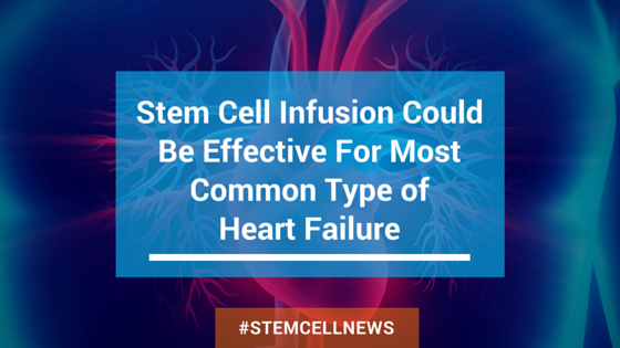 apr26-stem-cell-infusion-could-be-effective-for-most-common-type-of-heart-failure.png