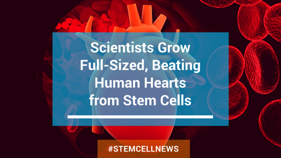 apr7-scientists-grow-full-sized-beating-human-hearts-from-stem-cells