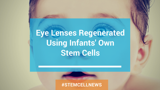 apr9-eye-lenses-regenerated-using-infants-own-stem-cells