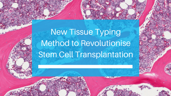 feb11-new-tissue-typing-method-for-stem-cell-transplantation