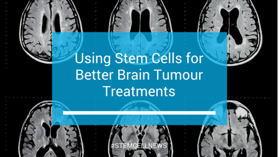 mar11-using-stem-cells-for-better-brain-tumor-treatments