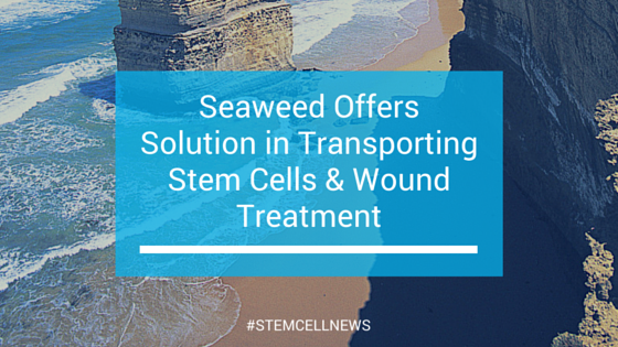 mar2-transporting-stem-cells-and-wound-treatment-using-seaweed