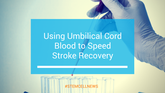 mar28-using-umbilical-cord-blood-to-speed-stroke-recovery