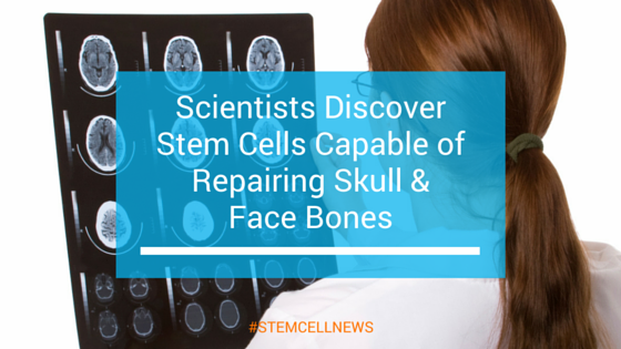mar4-scientists-discover-stem-cells-capable-of-repairing-skull-face-bones