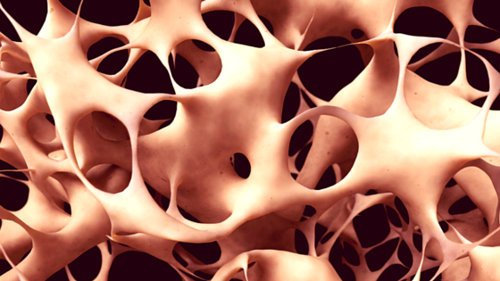 May_18-Experimental_Stem_Cell_Treatment_Reverses_Osteoporosis.png