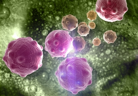 Nov23-Doctors Use Stem Cells to Grow Healthy Cells for Cancer Patients.jpg