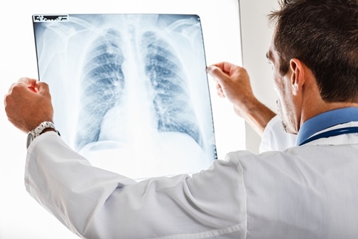 Doctor_examining_a_radiography