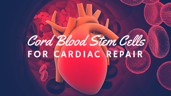 umbilical-cord-blood-stem-cells-for-cardiac-repair
