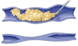 scleromousse.png