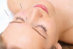 Acupuncture for Sinus Headaches: A Proven Treatment