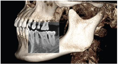 Invivo 5.2 lightbox