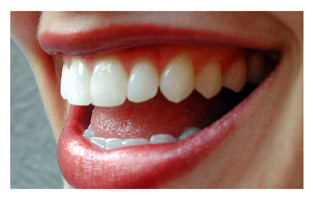 Smile