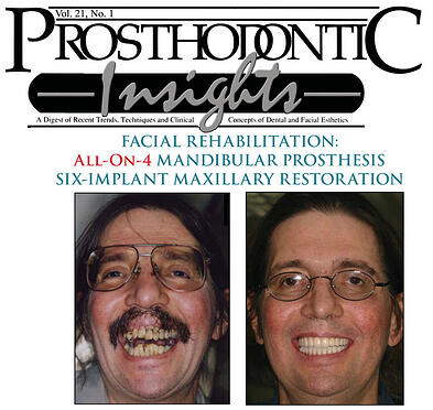 Facial Rehabilitation Using The All-On-4 Mandibular Prosthesis
