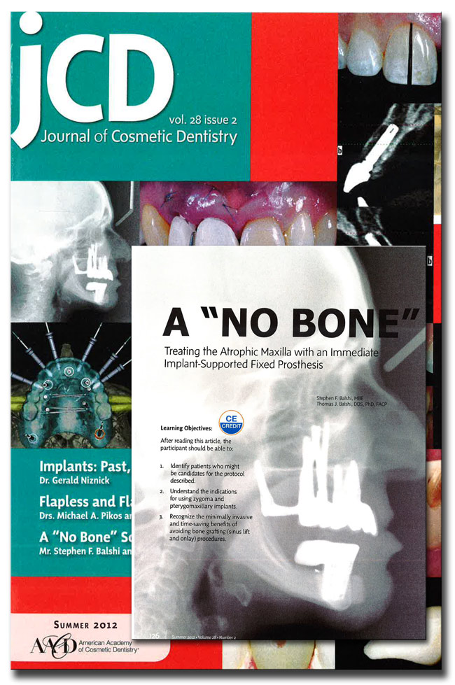 No Bone Solution Dental Implant Treatment