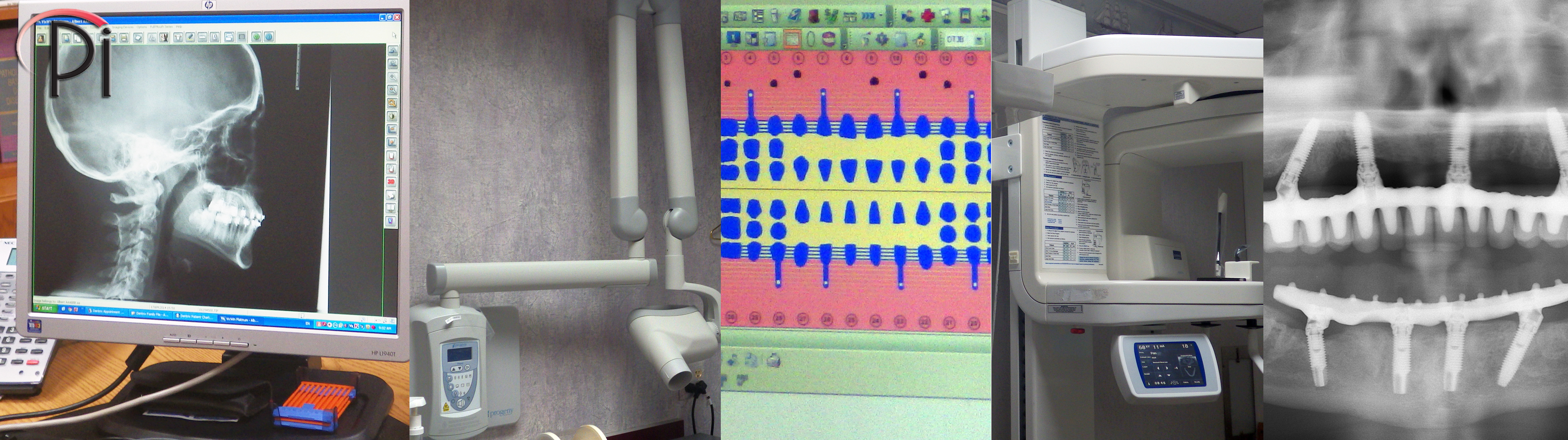 The importance of dental X-rays