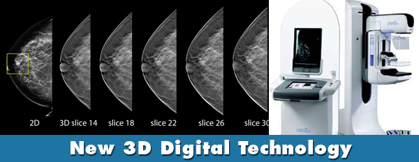 Ge tomosynthesis