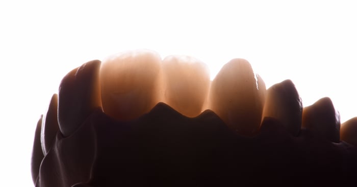 Buono a sapersi: ecco perché la tenacità alla rottura è così importante quando si parla di ossido di zirconio e materiali affini