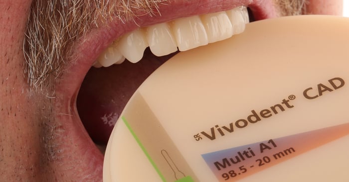 Disruptive innovation: The advantages of Digital Denture technology for your practice and laboratory